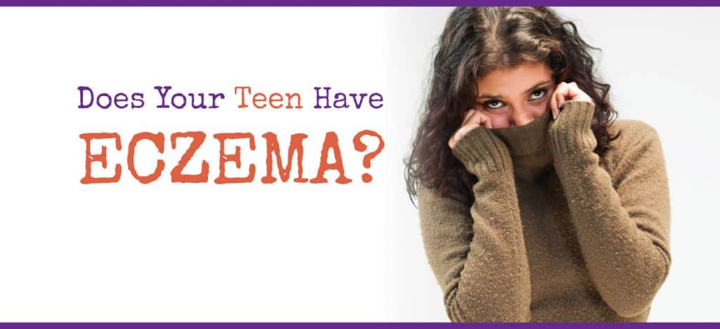 Eczema clinical study image of teen