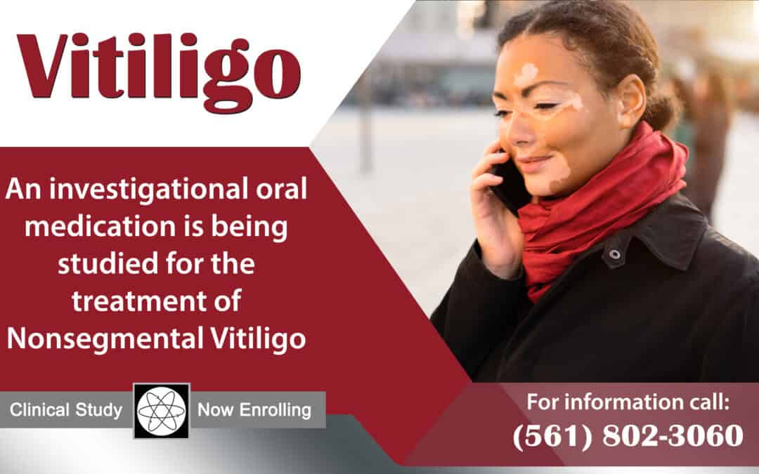 New Vitiligo Study